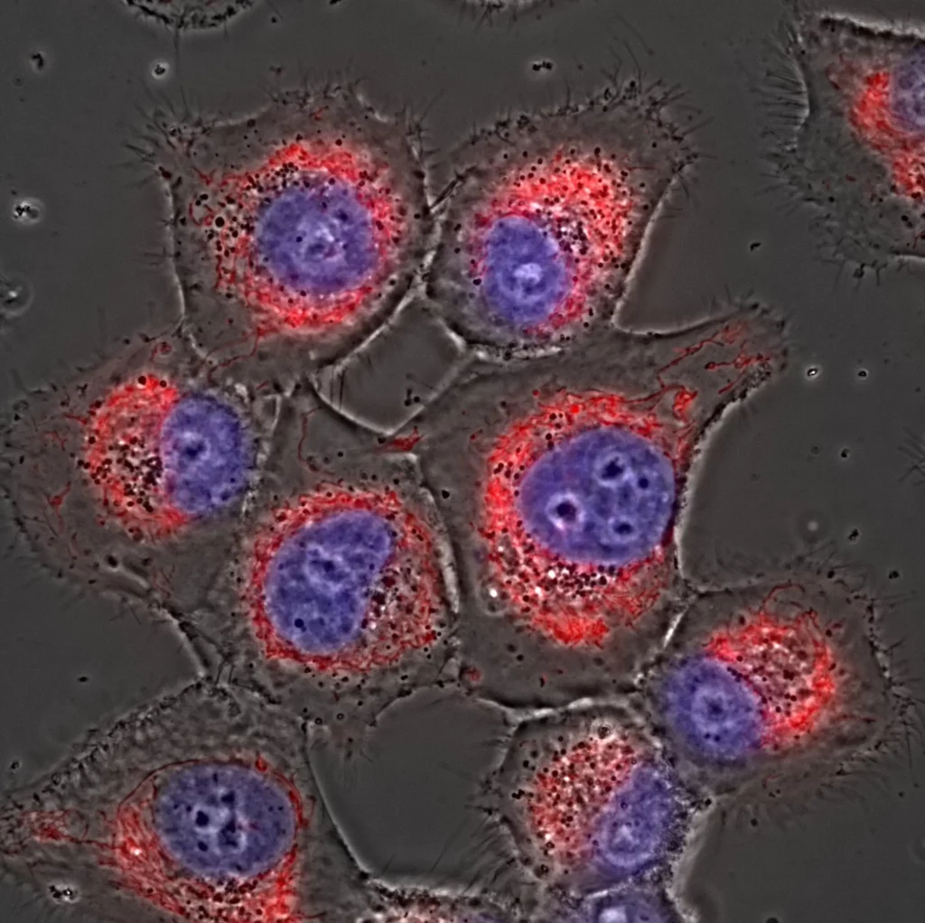 Imagerie via microscope Nikon I-SPT