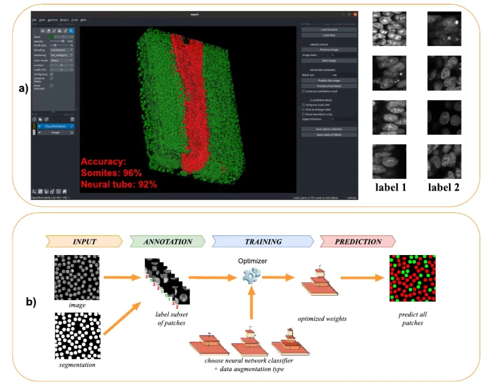 Schéma Segmentation et classification d'images biologiques
